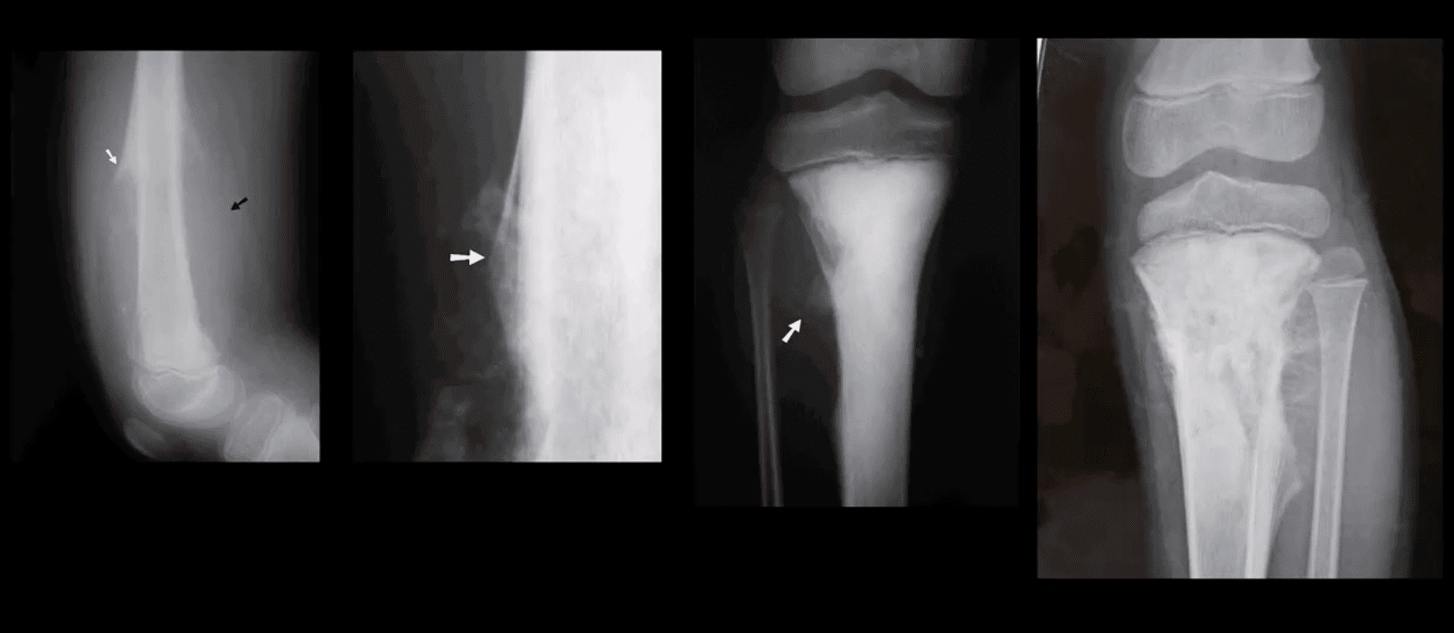 knee pain chiropractic treatment el paso tx.