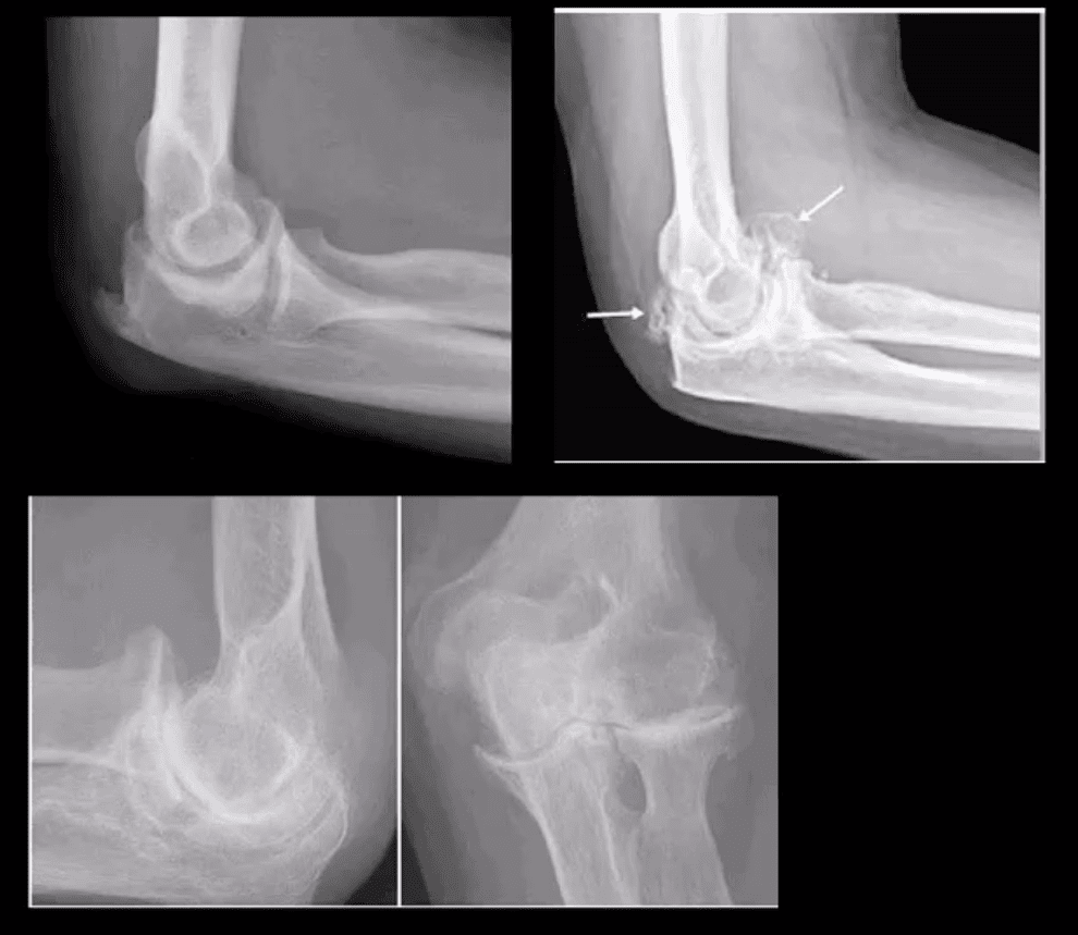 elbow imaging el paso tx.