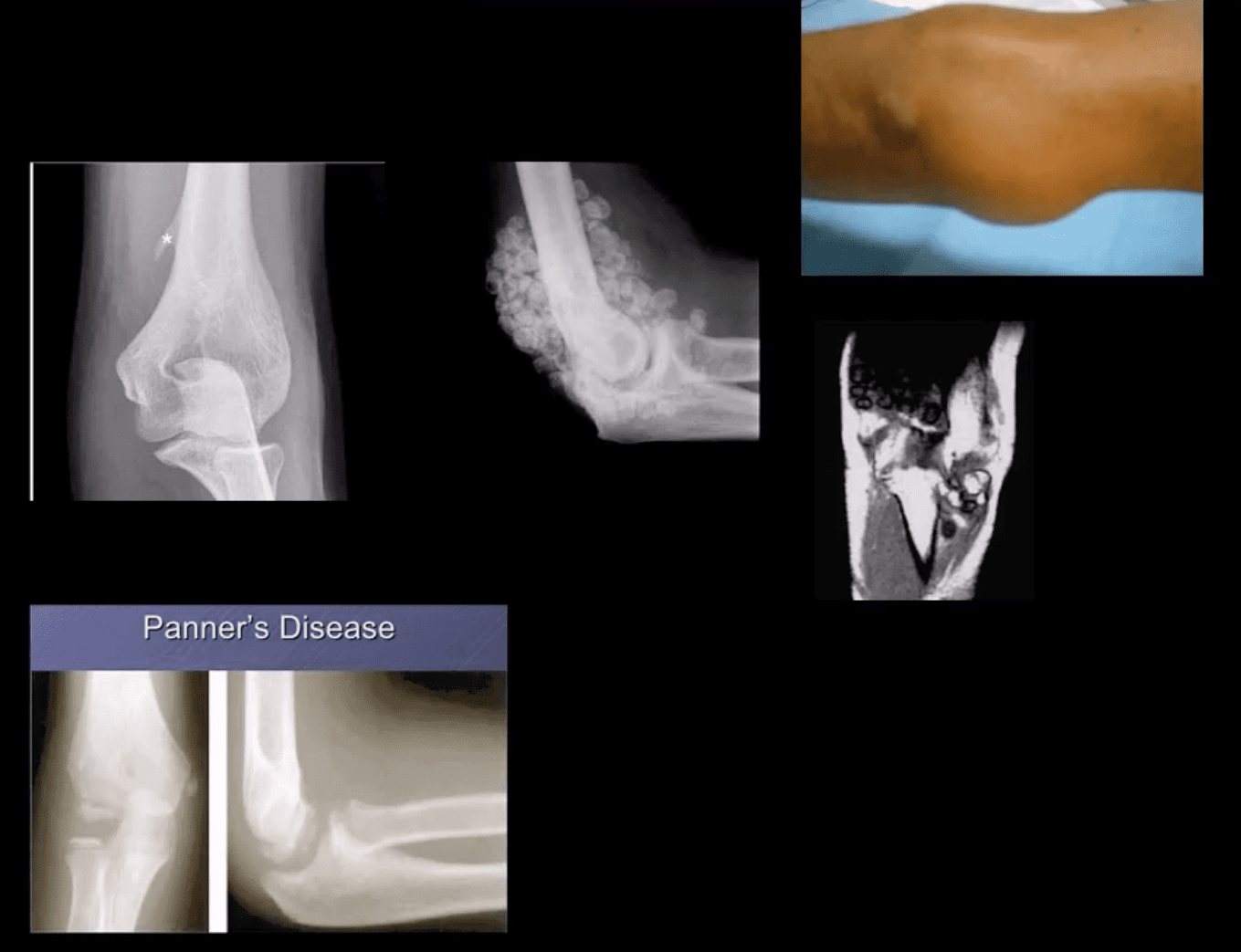 elbow imaging el paso tx.