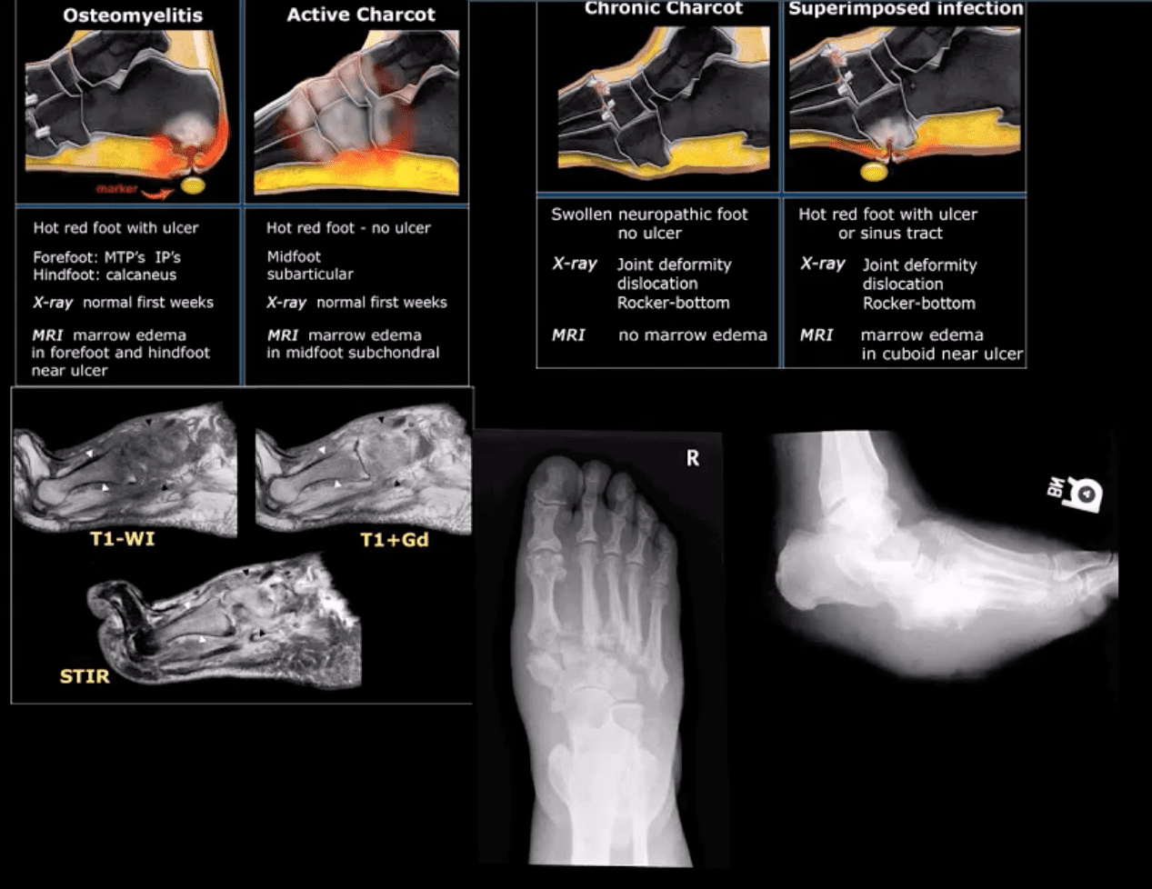 ankle foot arthritis and trauma el paso tx.