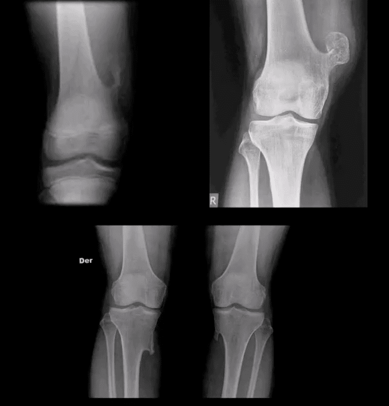 Dolor de rodilla tratamiento quiropráctico el paso tx.