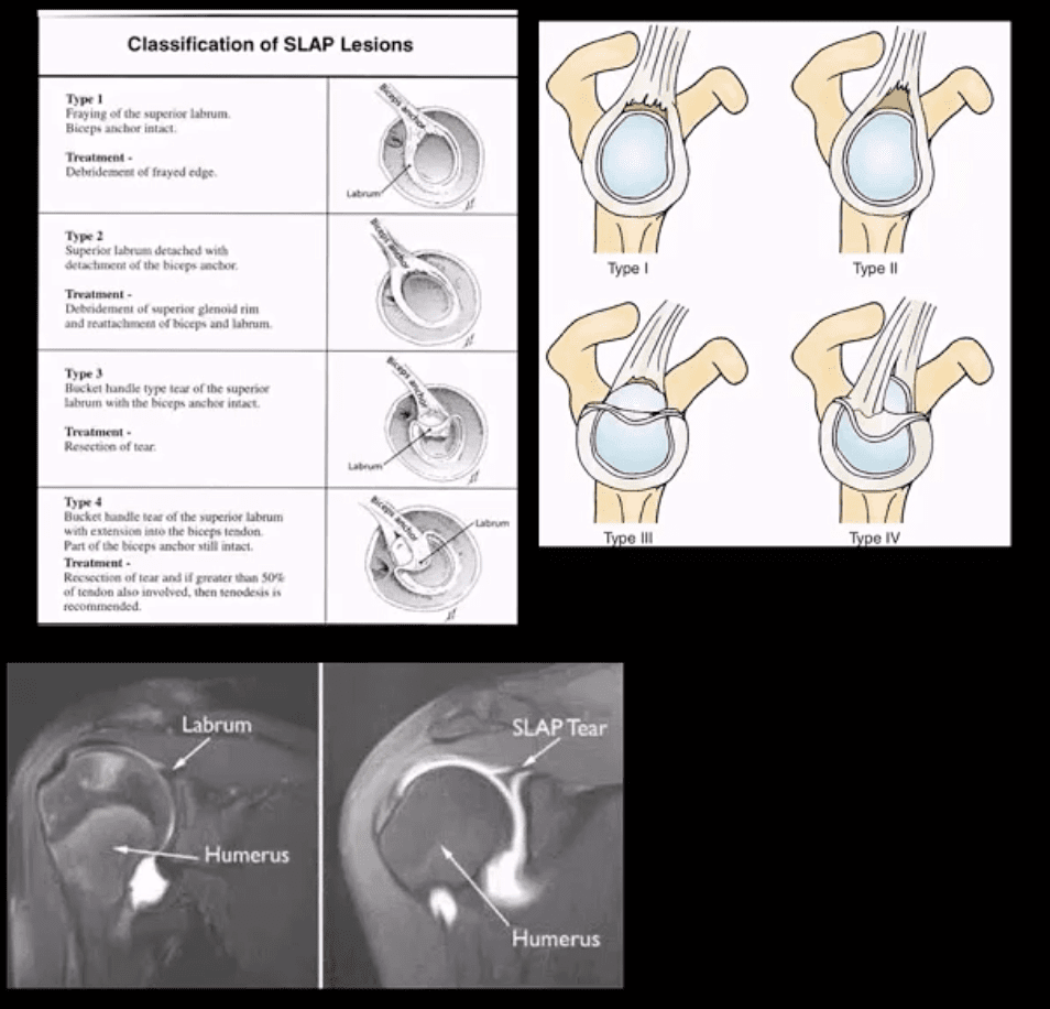 Shoulder Diagnostic Imaging Approach El Paso TX Shoulder Diagnostic Imaging Approach El Paso TX