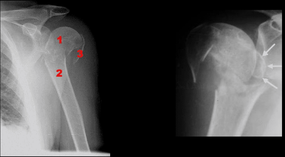 shoulder imaging el paso tx.