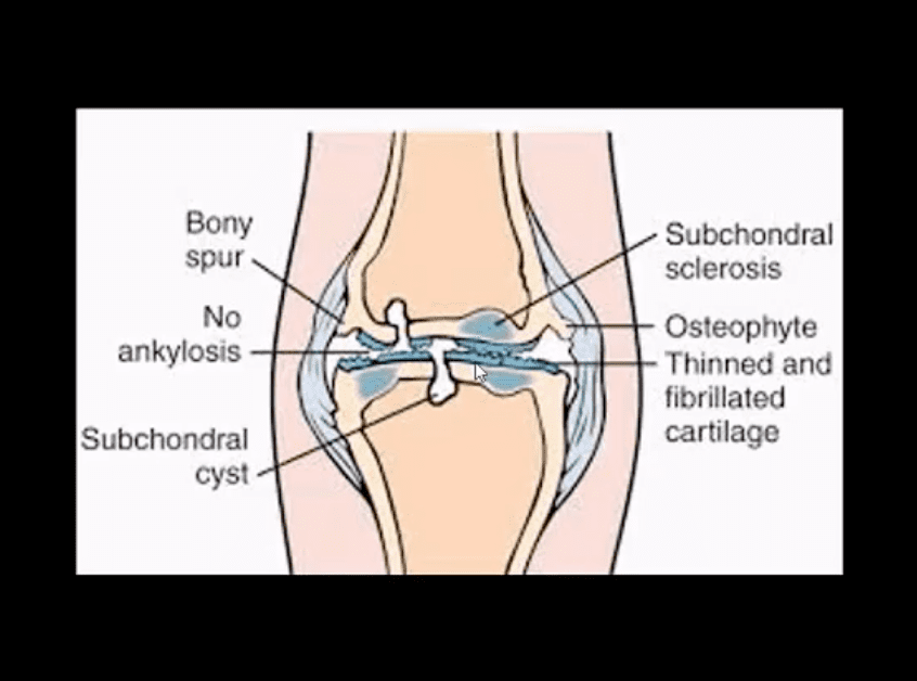 orokun ibọn chiropractic knee pasto tx.