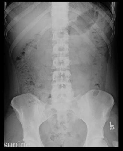 Imagen diagnóstica de abdomen el paso tx.