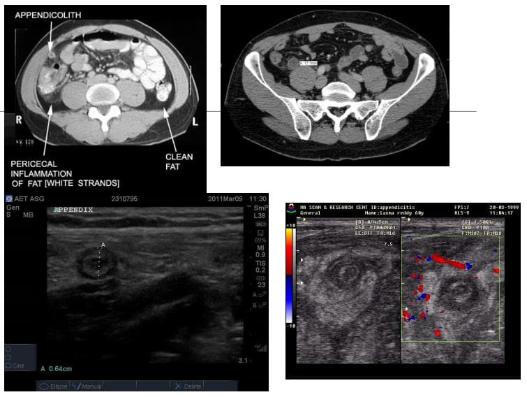 abdomen diagnostic imaging el paso tx.