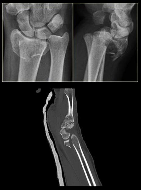 diagnostica del polso a mano imaging el paso tx.