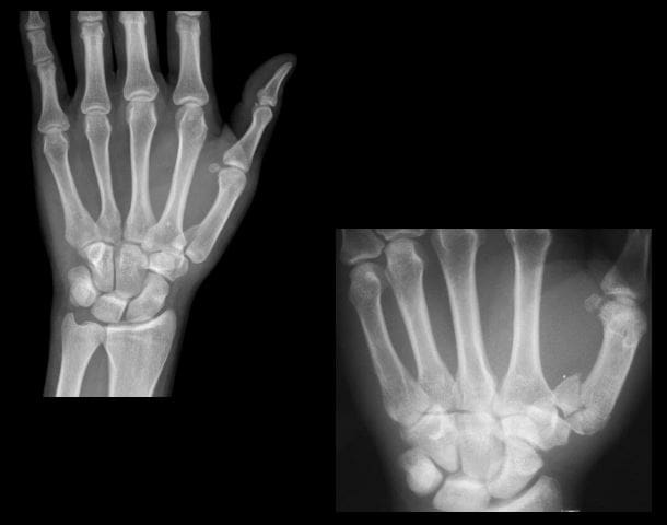 diagnostica del polso a mano imaging el paso tx.