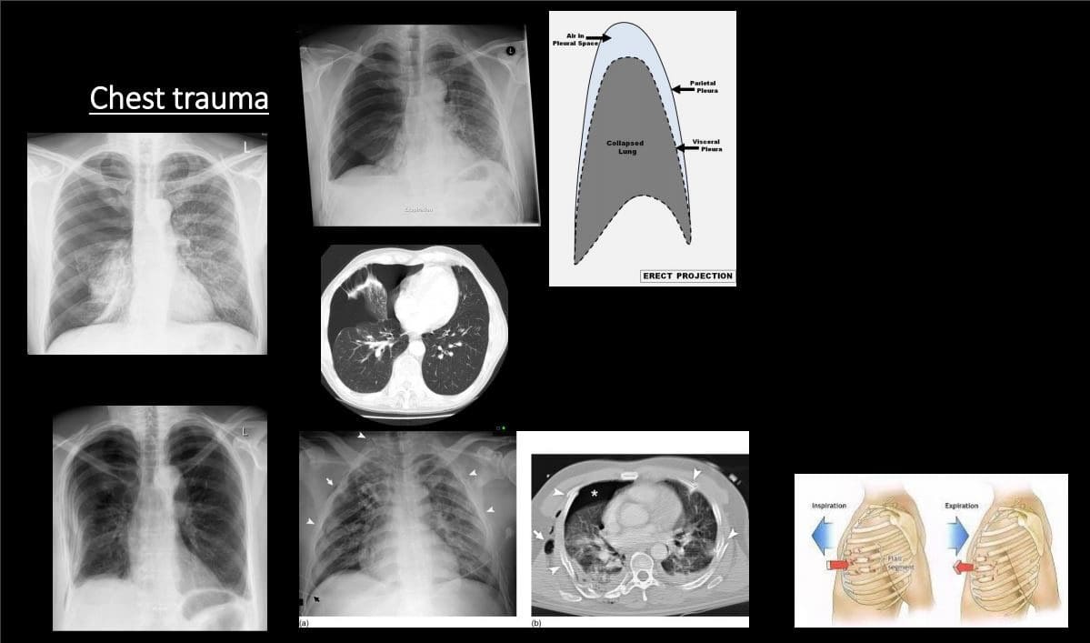 chest diagnostic imaging el paso tx.