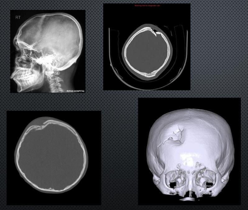 head trauma imaging el paso tx.