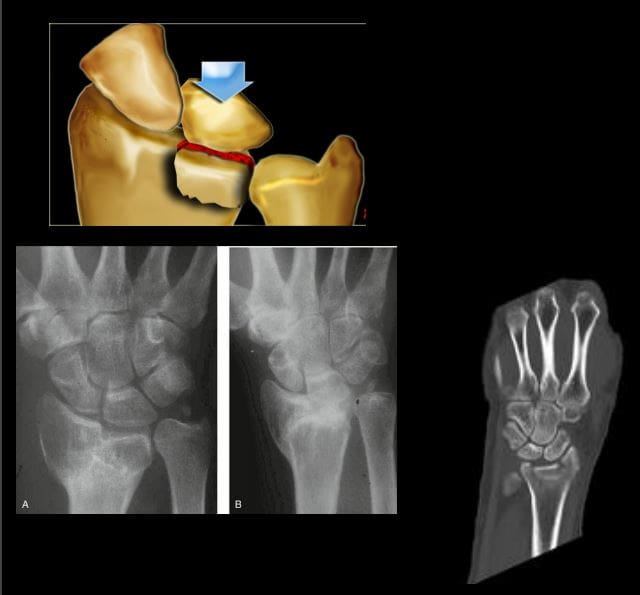 diagnostica del polso a mano imaging el paso tx.