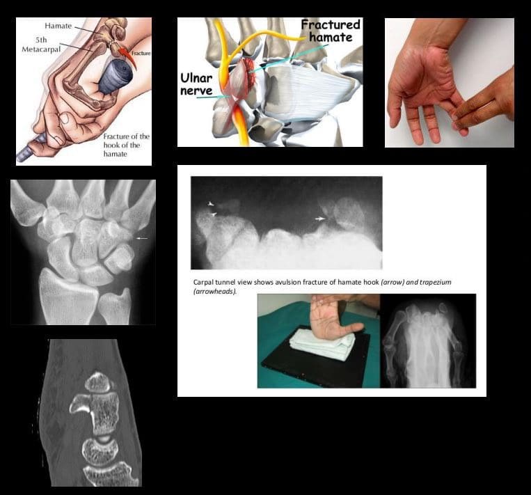 diagnostic imaging sa pulso sa kamot el paso tx.