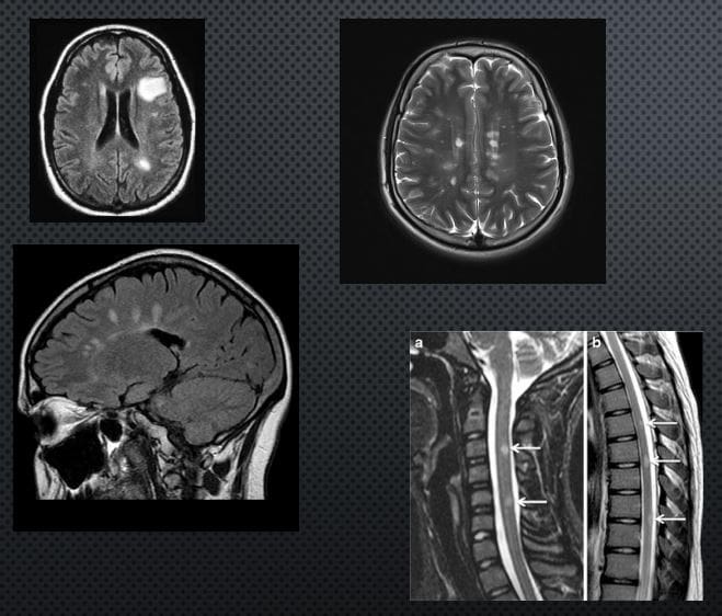 head trauma imaging el paso tx.