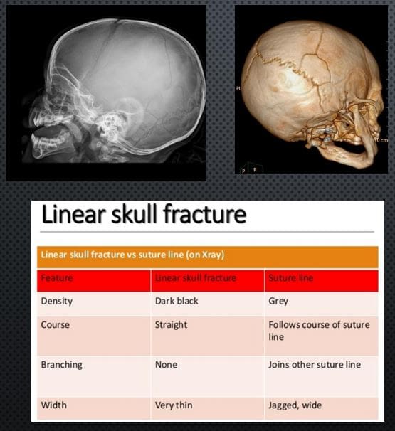 head trauma imaging el paso tx.