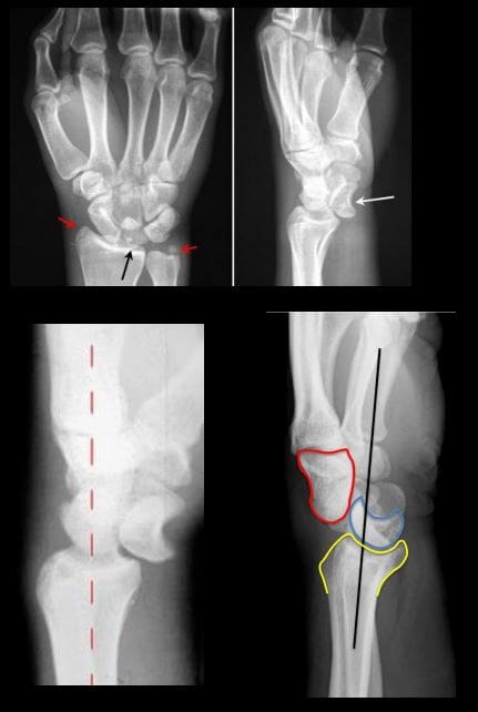 diagnostica del polso a mano imaging el paso tx.