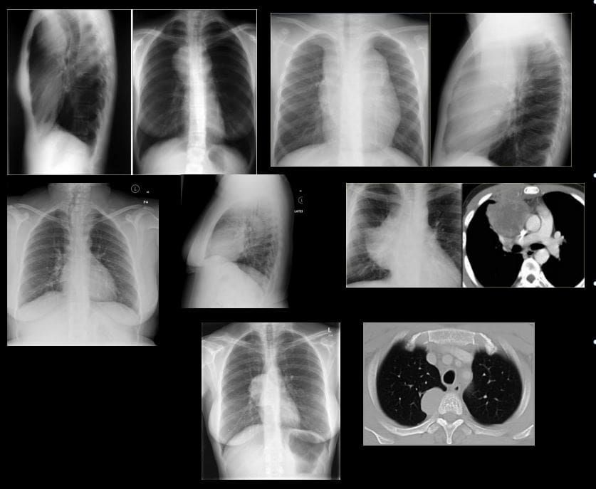 diagnostické zobrazovanie hrudníka el paso tx.