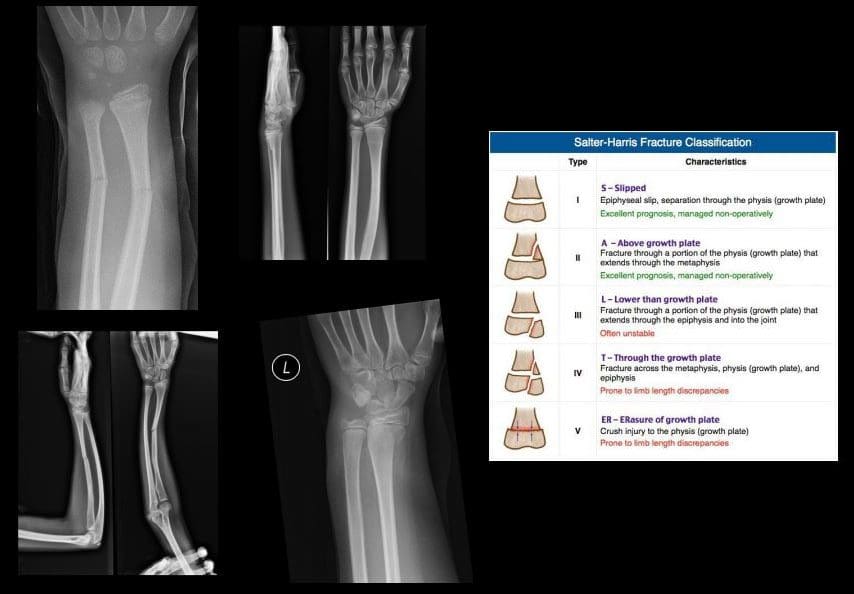 pergelangan tangan pencitraan diagnostik el paso tx.