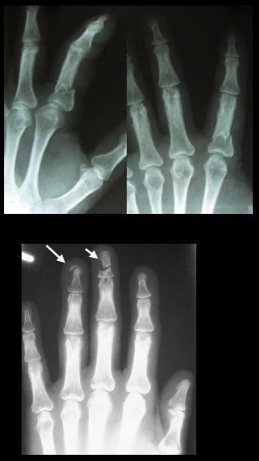 diagnostica del polso a mano imaging el paso tx.