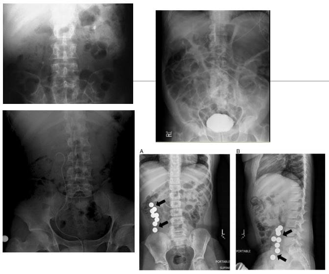 Imagen diagnóstica de abdomen el paso tx.
