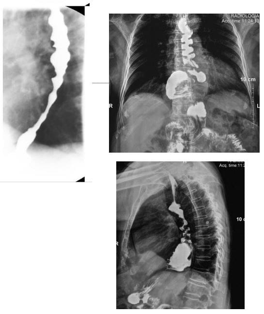 Imagen diagnóstica de abdomen el paso tx.