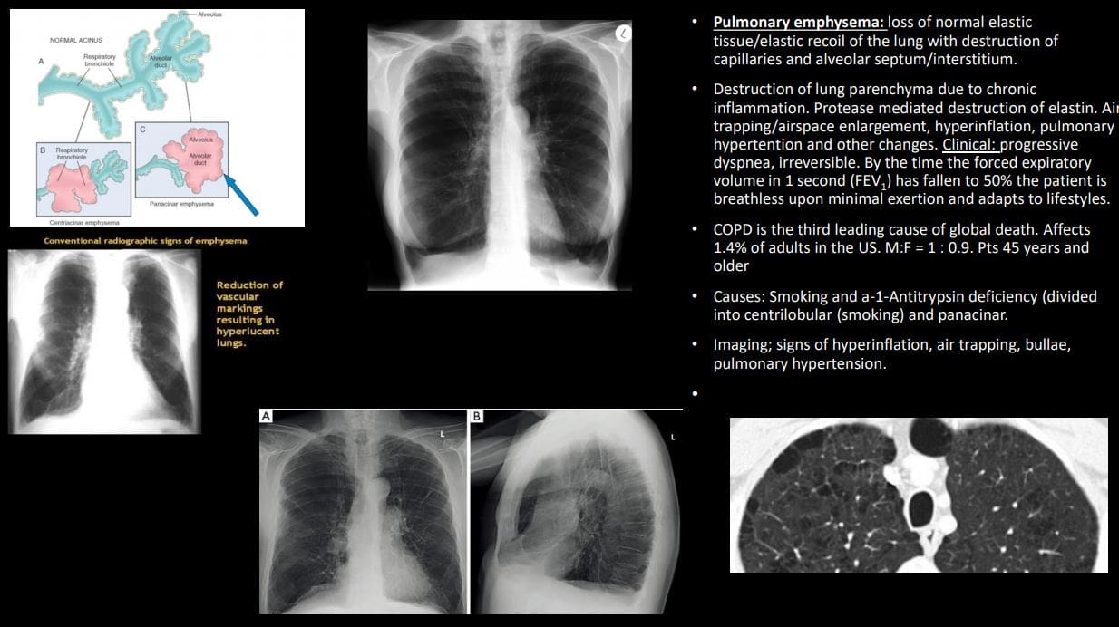 diagnostické zobrazovanie hrudníka el paso tx.