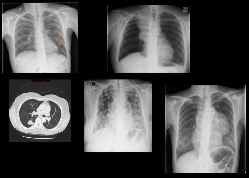 diagnostické zobrazovanie hrudníka el paso tx.