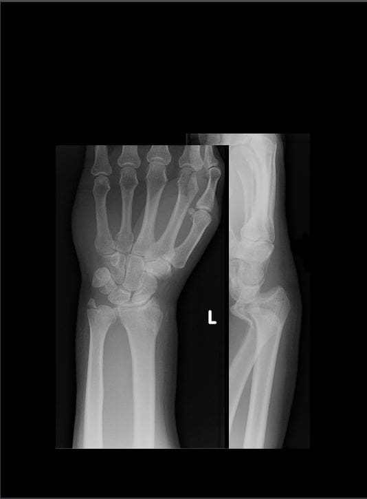 wrist hand diagnostic imaging el paso tx.