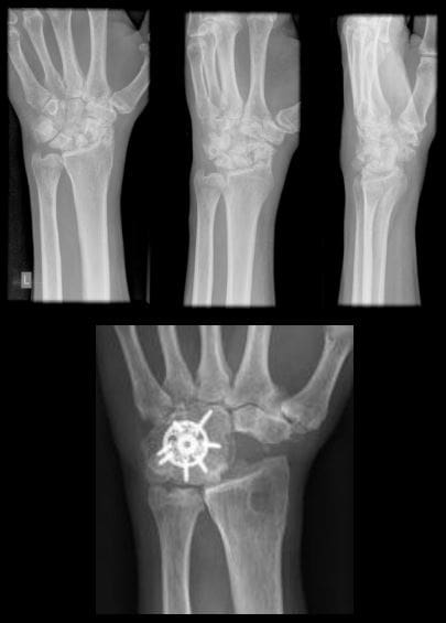 diagnostica del polso a mano imaging el paso tx.