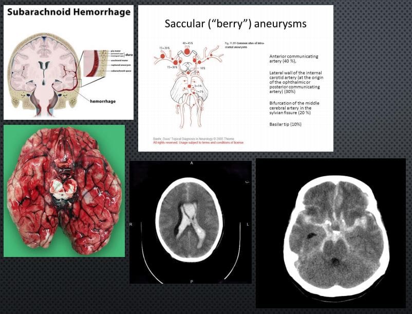 head trauma imaging el paso tx.