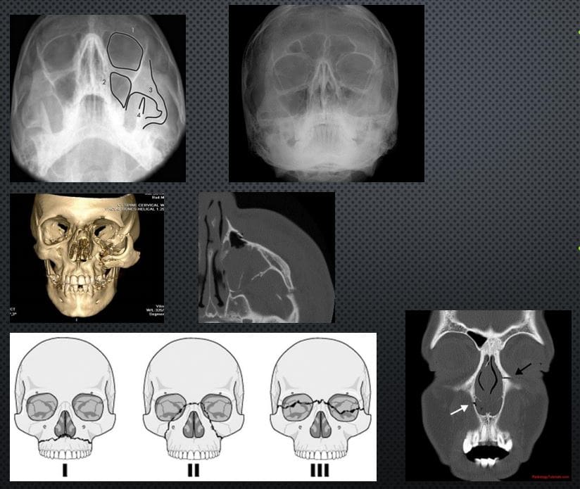 head trauma imaging el paso tx.