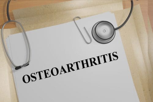 11860 Vista Del Sol, Ste. 128 How Chiropractic Helps Osteoarthritis El Paso, TX.