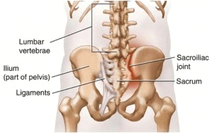 sacroiliac joint dysfunction diagram | El Paso, TX Chiropractor