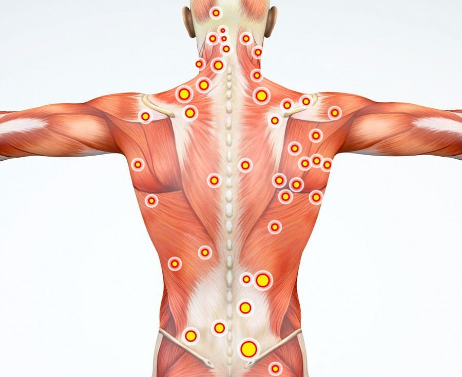 11860 Vista Del Sol, Ste. 126 Myofascial Trigger Points and Neck Pain El Paso, TX.