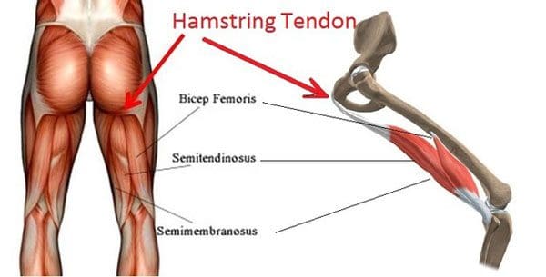 11860 Vista Del Sol, Ste. 128 Tight/Sore Hamstrings Benefit With Chiropractic Manipulation