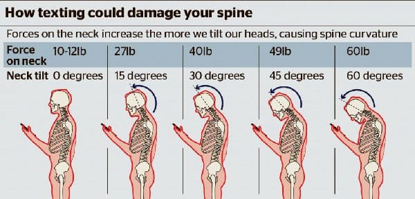 11860 Vista Del Sol, Ste. 128 Menghilangkan Migrain Dari Sumbernya dengan Perawatan Chiropractic