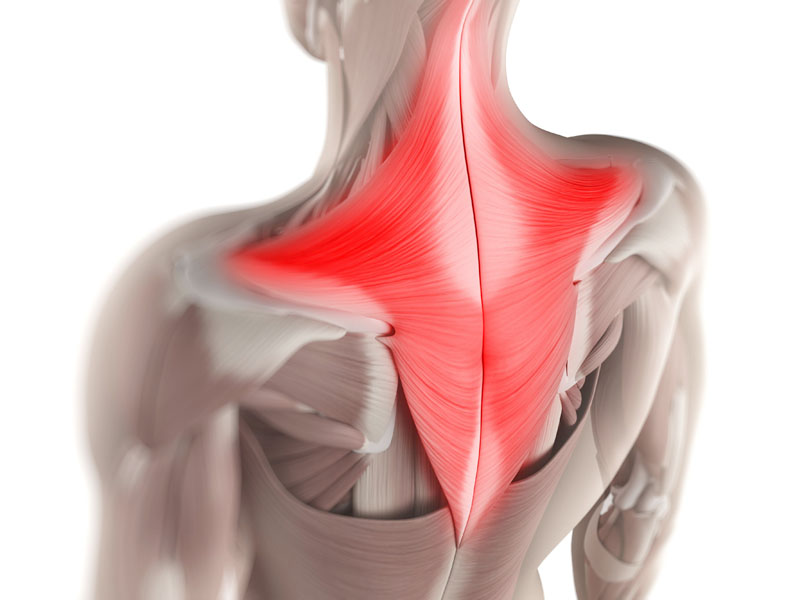 Trapezius Muscle Spasm Pain Relief: What You Need to Know